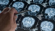 Araştırma: Derin uyku Alzheimer’ı yavaşlatıyor