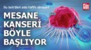 Bu belirtileri asla hafife almayın! Mesane kanseri böyle başlıyor