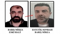Cinayete azmettiren şüpheli, ameliyatla yüzünü değiştirmiş