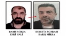 Cinayete azmettiren şüpheli, ameliyatla yüzünü değiştirmiş
