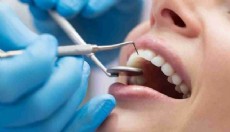 Diş minesini onaran yeni jel: Çürüklerin sonu mu geliyor?