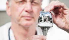 Diz Sorunlarında Güncel Tedaviler ve Gerçek Hasta Deneyimleri