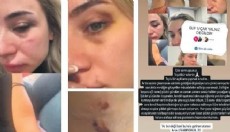 Elif öğretmenden yardım çığlığı