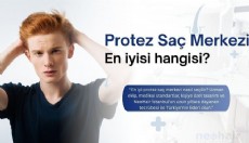 En İyi Protez Saç Merkezi Nasıl Seçilir? Ömürlük Kullanım!