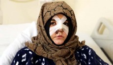 Eşinin dövdüğü Nazlı: Çıkarsa yarım bıraktığı işi tamamlar