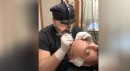 Este Surgery SDHI Hair Transplant