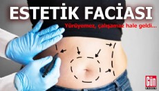 Estetik faciası: Yürüyemez, çalışamaz hale geldi