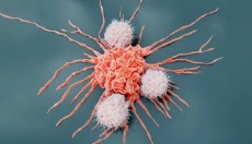 Gıda koruyucular kanser ve tip 2 diyabet riskini artırabilir