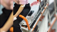 Görümce, eski yengesini bıçakladı