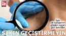 İşte cilt kanserinin gözden kaçan gizli belirtileri