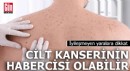 İyileşmeyen yaralara dikkat: Cilt kanserinin habercisi olabilir