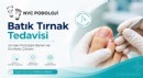 İzmir’de Batık Tırnak Sorununa Konforlu Çözüm: NVC Podoloji Alsancak’ta Hizmet Veriyor