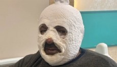 Kalorifer kazanını yakmak istedi canını zor kurtardı