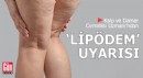 Kalp ve Damar Cerrahisi Uzmanı’ndan ‘lipödem’ uyarısı