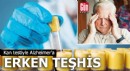 Kan testiyle Alzheimer’a erken teşhis