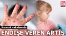 Kızamık vakalarında endişe veren artış