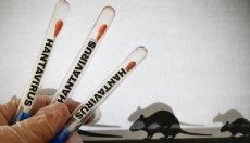 Ölümcül Hantavirüste sinsi tehlike