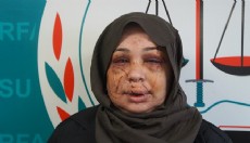 Polis eşi tarafından darbedildiği iddiasıyla şikayetçi oldu