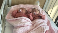 Prematüre ikizler, anjiyo ile hayata tutundu