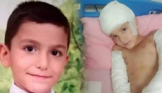 Sokak köpeği saldırısı davasında emsal karar