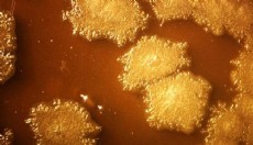 Tümörü içeriden yok eden 'akıllı' bakteriler geliştirildi