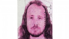 Türkiye'ye saç ekimi için gelen İngiliz hayatını kaybetti