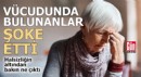 Vücudunda bulunanlar şoke etti! Halsizliğin altından bakın ne çıktı