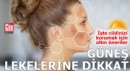 Yazın güneş lekelerine dikkat!