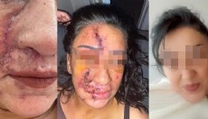 Yine estetik faciası