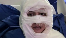 Yüzüne kolonya döküp ateşe verdiler