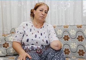 Elindeki uyuşma için gittiği hastanede kolundan oldu