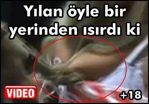 Erotik dansçıyı şov yaptığı yılanı ısırdı